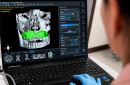 Qué es el flujo digital y cómo mejora tu tratamiento odontológico